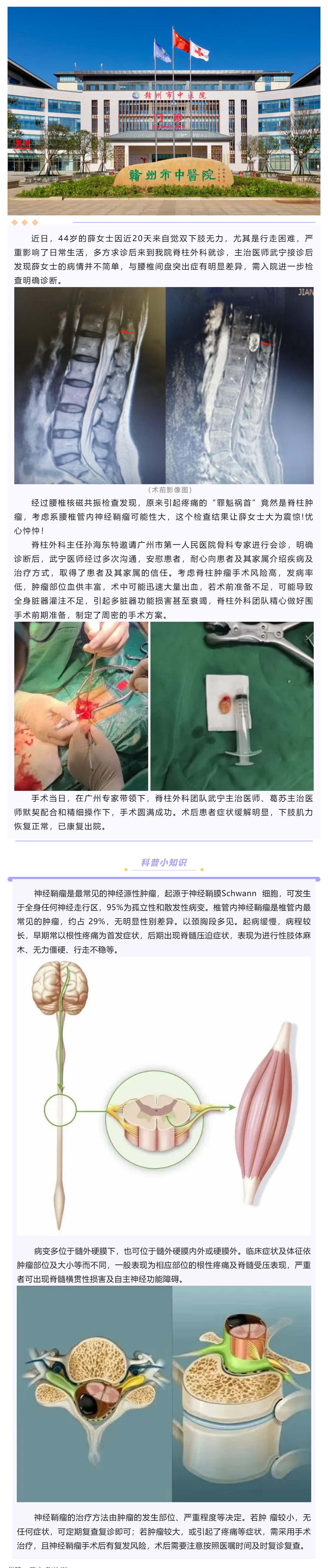 腰腿痛、下肢乏力麻木，提防神經(jīng)鞘瘤！.png